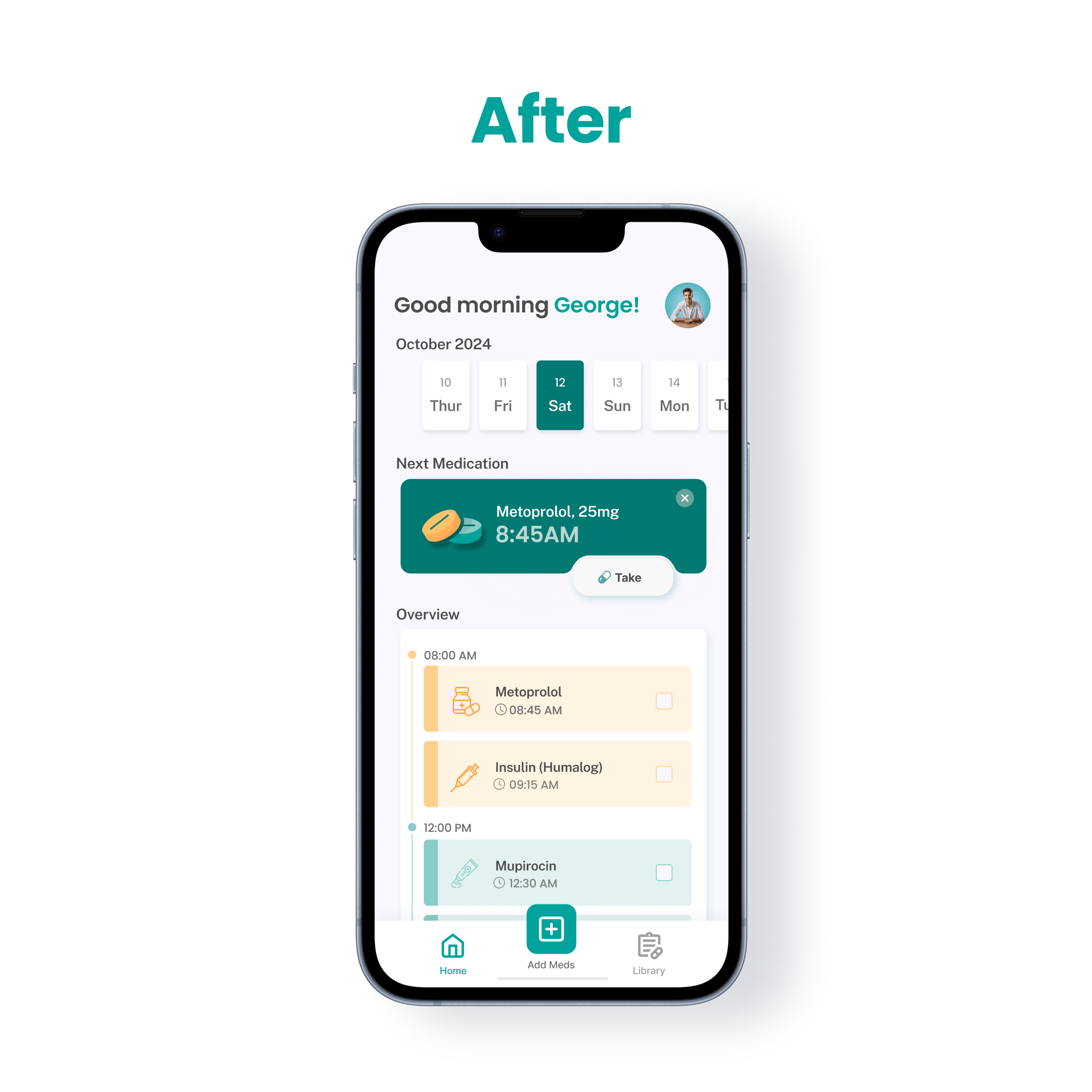 Upcoming medication logging After Usability Testing